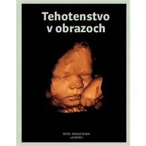 Tehotenstvo v obrazoch - Michal Holáň