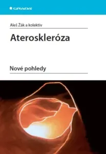 Ateroskleróza - Aleš Žák - e-kniha
