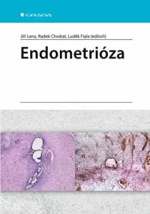 Endometrióza - Luděk Fiala, Jiří Lenz, Radek Chvátal - e-kniha