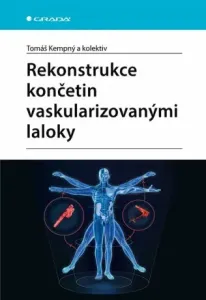 Rekonstrukce končetin vaskularizovanými laloky - kolektiv autorů, Tomáš Kempný - e-kniha