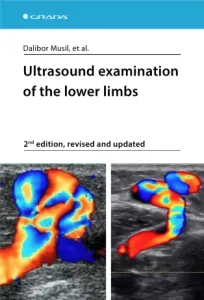 Ultrasound examination of the lower limbs - Dalibor Musil, et al. - e-kniha