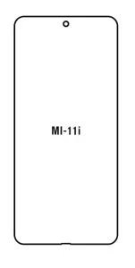 Hydrogel - ochranná fólie - Xiaomi Mi 11i (case friendly)