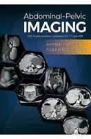 Abdominal-Pelvic Imaging - 200 Cases (Common Diseases): US, CT and MRI (Haouimi Ammar)(Paperback / softback)