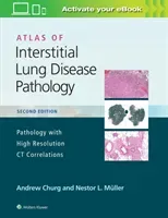 Atlas of Interstitial Lung Disease Pathology (Churg Andrew)(Pevná vazba)