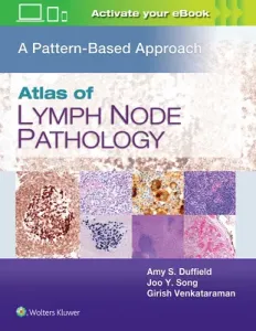 Atlas of Lymph Node Pathology: A Pattern Based Approach (Duffield Amy S.)(Pevná vazba)