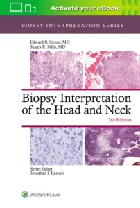 Biopsy Interpretation of the Head and Neck (Stelow Edward B.)(Pevná vazba)