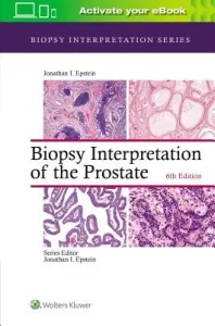 Biopsy Interpretation of the Prostate (Epstein Jonathan I.)(Pevná vazba)