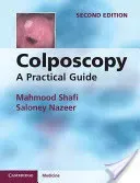 Colposcopy (Shafi Mahmood)(Paperback)