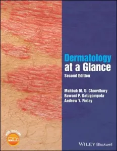 Dermatology at a Glance (Chowdhury Mahbub M. U.)(Paperback)
