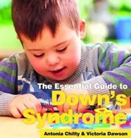 Down's Syndrome: The essential Guide (Duffy Robert)(Paperback)