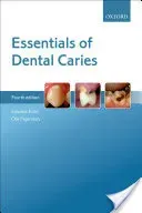 Essentials of Dental Caries (Kidd Edwina)(Paperback)