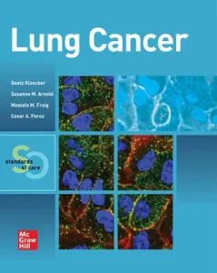 Lung Cancer: Standards of Care (Kloecker Goetz)(Paperback)