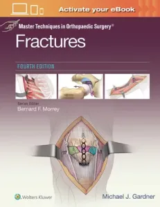 Master Techniques in Orthopaedic Surgery: Fractures (Gardner Michael J.)(Pevná vazba)