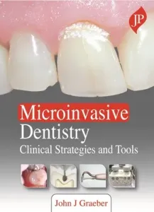 Microinvasive Dentistry - Clinical Strategies and Tools (Graeber John J)(Pevná vazba)