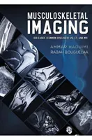 Musculoskeletal Imaging - 100 Cases (Common Diseases) US, CT and MRI (Haouimi Ammar)(Paperback / softback)