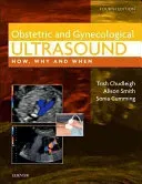 Obstetric & Gynaecological Ultrasound: How, Why and When (Chudleigh Trish)(Pevná vazba)