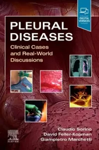 Pleural Diseases - Clinical Cases and Real-World Discussions(Paperback / softback)