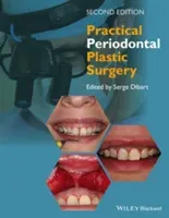 Practical Periodontal Plastic Surgery (Dibart Serge)(Pevná vazba)