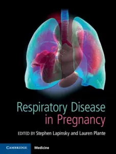Respiratory Disease in Pregnancy (Lapinsky Stephen E.)(Pevná vazba)