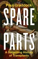 Spare Parts - A Surprising History of Transplants (Craddock Paul)(Pevná vazba)