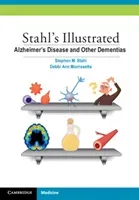 Stahl's Illustrated Alzheimer's Disease and Other Dementias (Stahl Stephen M.)(Paperback)