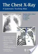 The Chest X-Ray: A Systematic Teaching Atlas (Hofer Matthias)(Paperback)