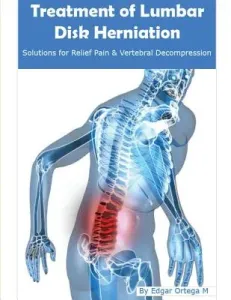 Treatment of Lumbar Disk Herniation: Back Pain Relief and Herniated Discs Solutions (Maldonado Edgar Ortega)(Paperback)