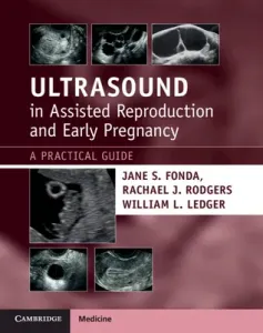 Ultrasound in Assisted Reproduction and Early Pregnancy: A Practical Guide (Fonda Jane S.)(Paperback)