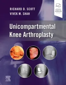 Unicompartmental Knee Arthroplasty (Scott Richard D.)(Pevná vazba)
