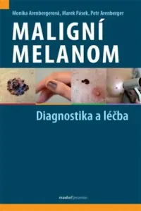 Maligní melanom - Diagnostika a léčba - Petr Arenberger, Monika Arenbergerová, Marek Pásek