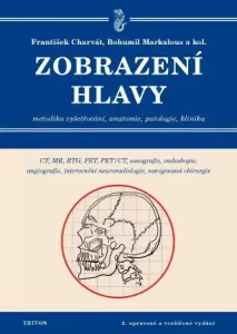 Zobrazení hlavy - Bohumil Markalous, František Charvát - e-kniha